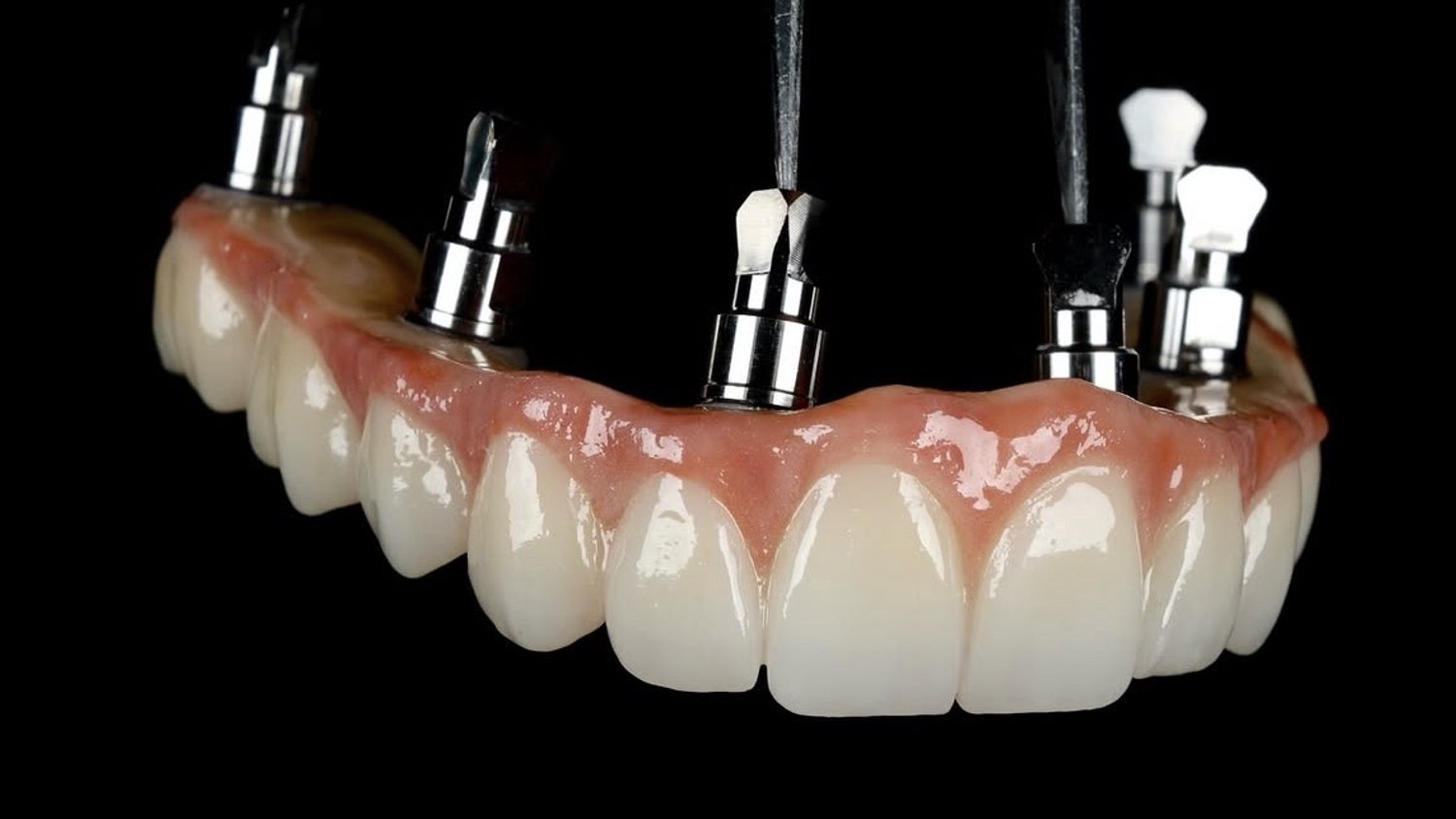 Rehabilitación oral